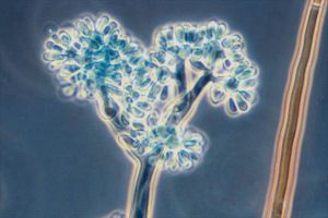 Botrytis cinerea observed in microscope
